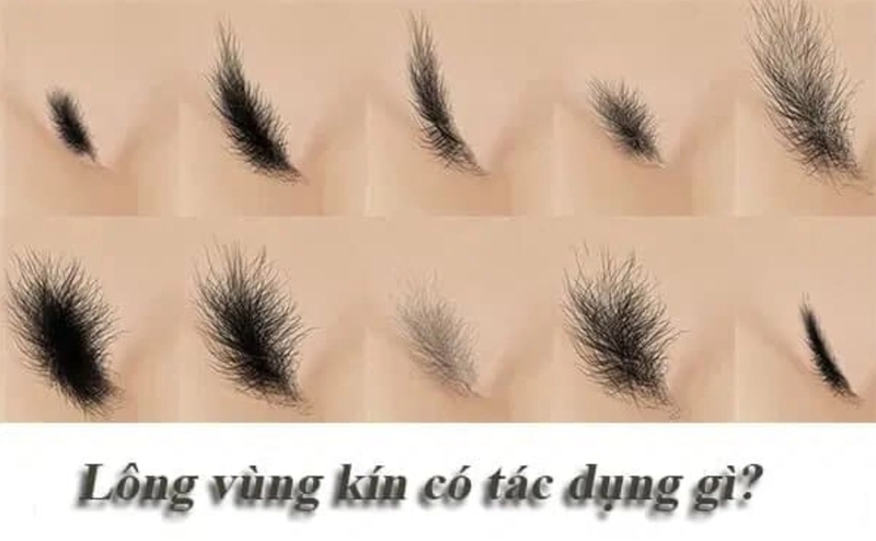 Lông vùng kín là đặc điểm sinh lý tự nhiên, có vai trò giảm ma sát và bảo vệ vùng da nhạy cảm. 