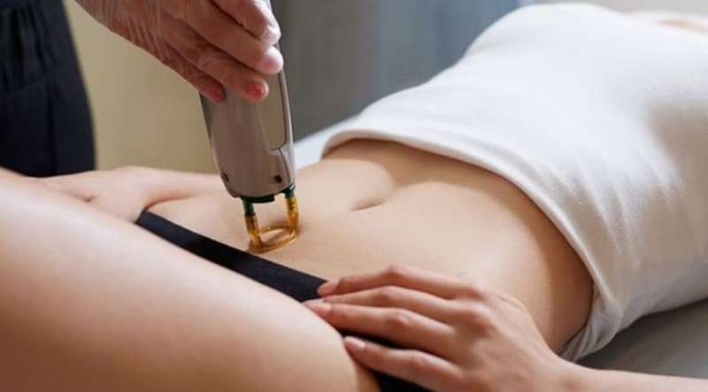 Triệt lông vùng kín thường xuyên chỉ nên thực hiện khi da khỏe và được chăm sóc đúng cách. 
